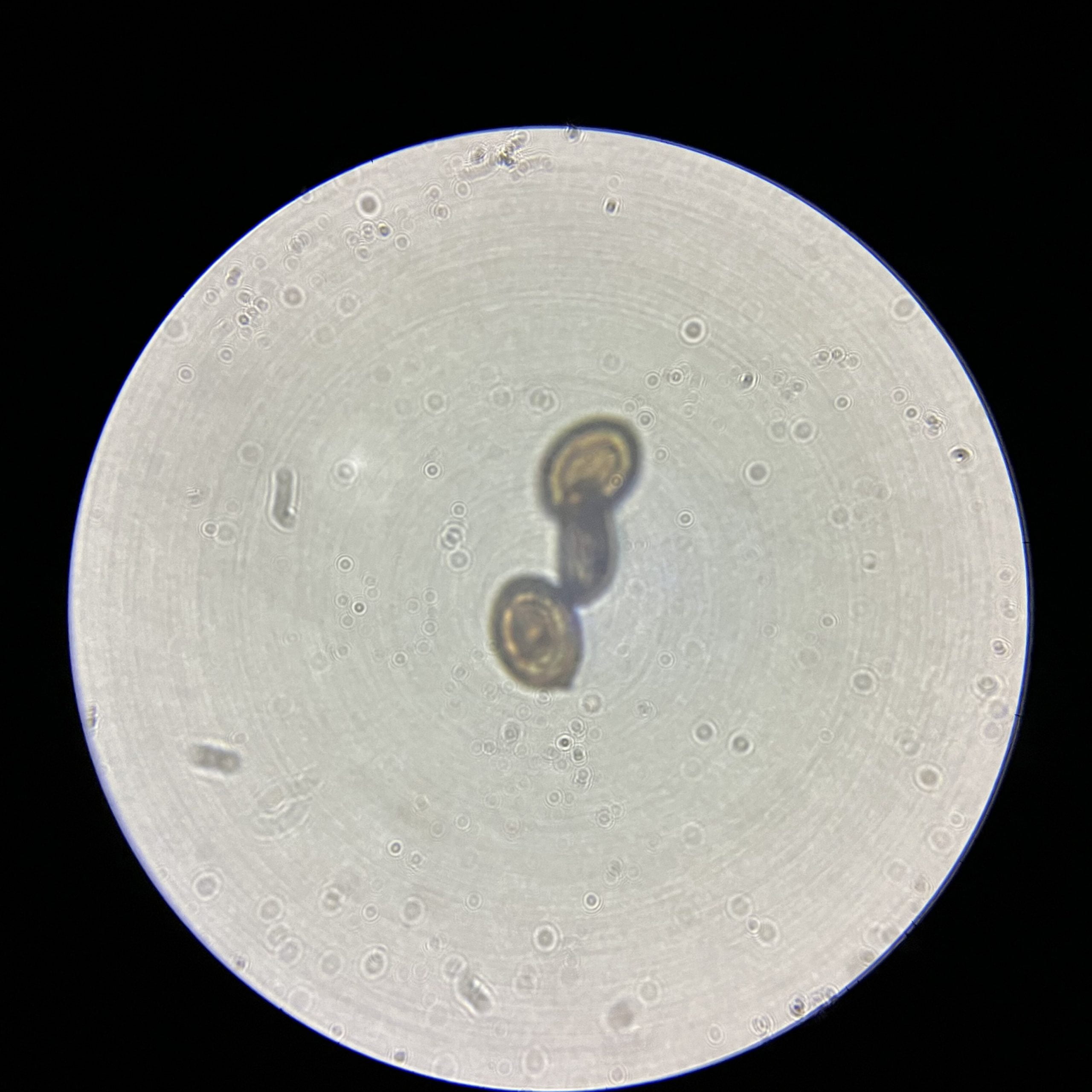 1000x magnification of Lord Of Spore Golden Teacher Spores.